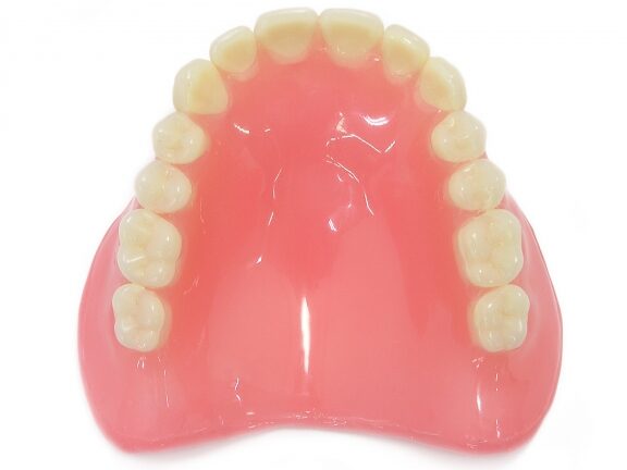 総入れ歯 どうやってくっついてる仕組みと方法